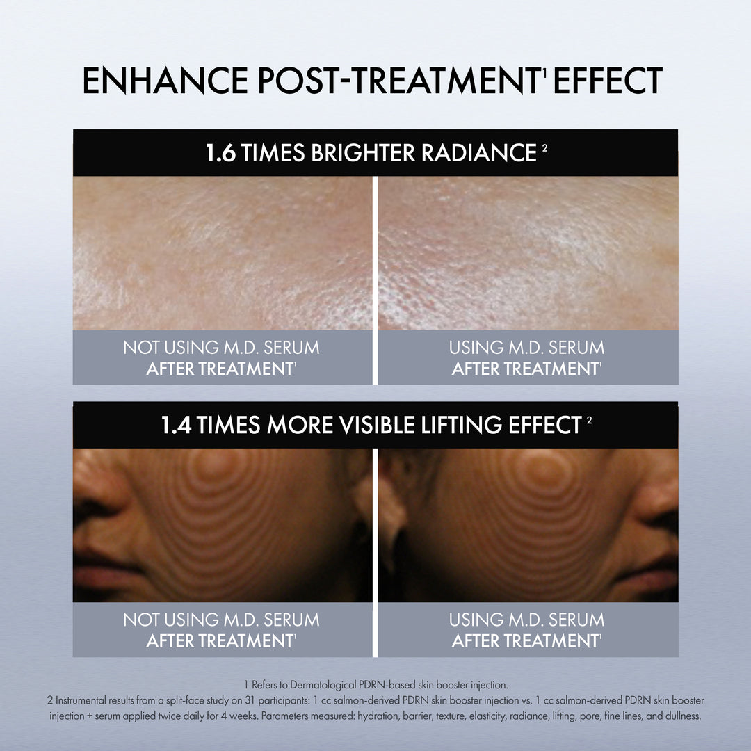 Rejuvenating Booster Shot M.D. Serum, instrumental study results that show an enhanced post-treatment effect