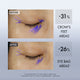 Enlarge image of Lift &amp;amp; Firm Dual Eye Treatment